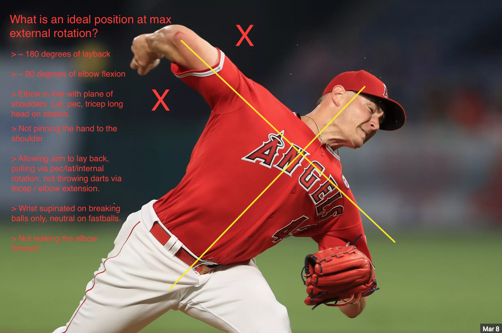 How to Fix a Pushing Arm Action 7 Causes and Solutions